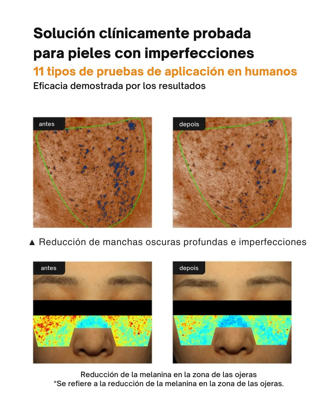 Crema Antimanchas