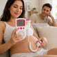 Doppler Fetal para Escuchar el Latido del Bebé