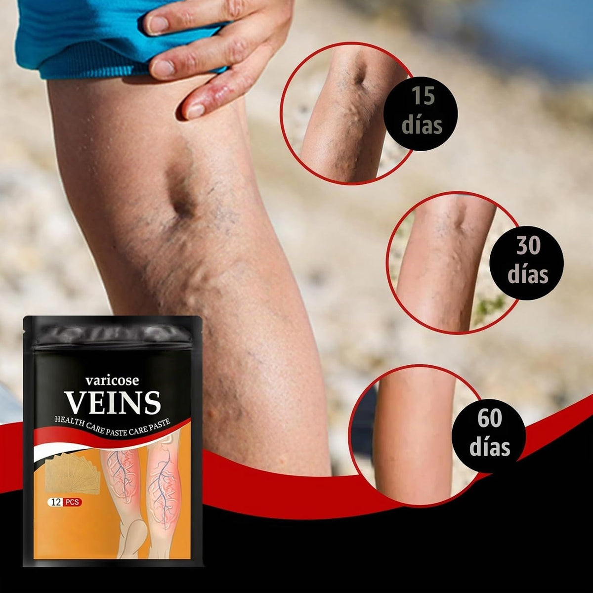 VARICOSE – Parches Herbales para el Cuidado de las Piernas