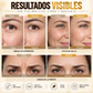 Cinta Facial Nocturna para Líneas de Expresión y Efecto Lifting