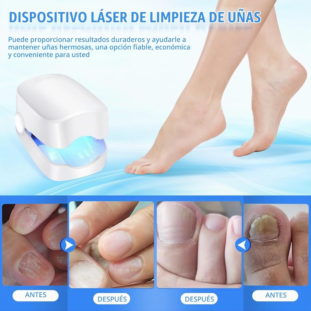 Dispositivo Antihongos para Uñas con Tecnología de Doble Luz