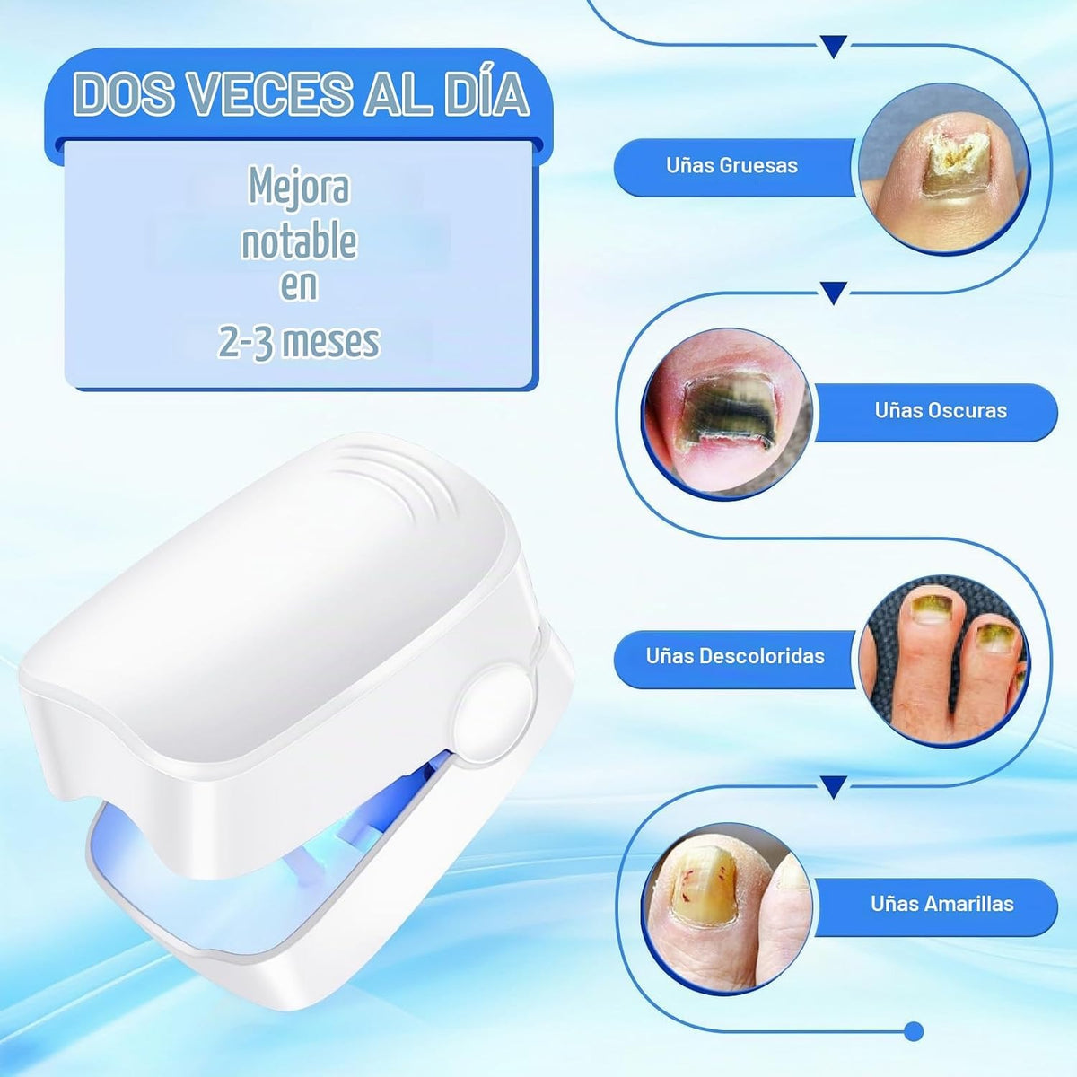 Dispositivo Antihongos para Uñas con Tecnología de Doble Luz
